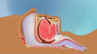 Hyoid Suspension [upl. by Hpesoy]