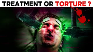 Ye Treatment hai ya TORTURE  Aversion Therapy [upl. by Aikal254]