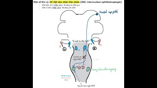 HC LIỆT VẬN NHÃN LIÊN NHÂN INO internuclear ophthalmoplegia CƠ CHẾ [upl. by Cowley86]