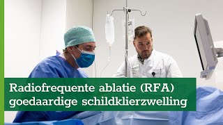 Radiofrequente ablatie RFA bij goedaardige schildklierzwelling [upl. by Saba785]