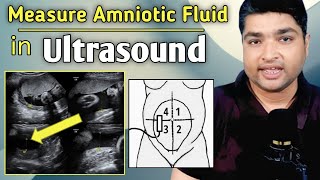 How to measure amniotic fluid index by ultrasound  Amniotic fluid level chart during pregnancy [upl. by Silvain45]