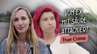 SäureAngriff überlebt Wie Vanessa nach der Attacke zu sich selbst fand [upl. by Nonna]