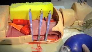 Thoracotomy Simulation [upl. by Renato]