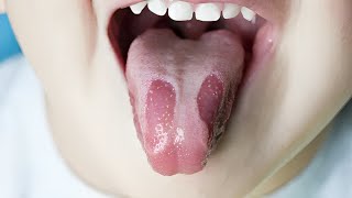 20 Shocking Facts About Tongue You Never Knew😨 [upl. by Ocimad]