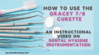 How to use the Gracey 78 Curette [upl. by Paulita321]