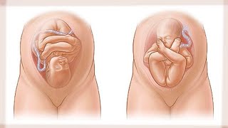 Zoom sur les positions de bébé avant laccocuhement [upl. by Civ]