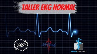 Taller Electrocardiograma Normal [upl. by Dachi]