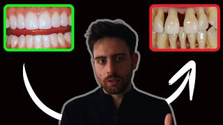 How Smoking amp Vaping DESTROY Your Teeth and Gums [upl. by Ysteb79]