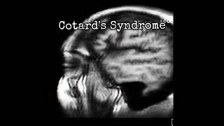 Episode 29 Cotard’s Syndrome [upl. by Fina942]