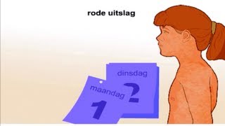 Rode hond  Symptomen en behandeling [upl. by Nelag]