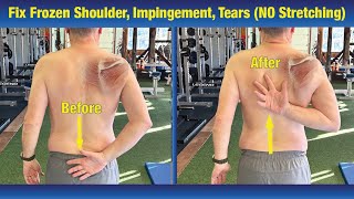 INCREDIBLE way to Fix Frozen Shoulder amp Impingement  NO Stretching or PT Exercises [upl. by Ennovahc]