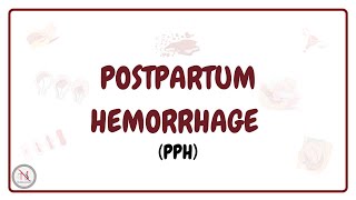 Postpartum Hemorrhage  Types  Causes  Diagnosis  Medical Management  Nursing Management [upl. by Kina737]