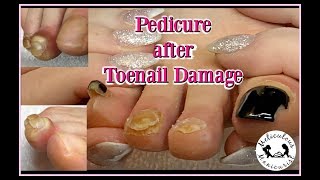 Pedicure Lessons Online for Damaged Toenails 👍 [upl. by Saleem]