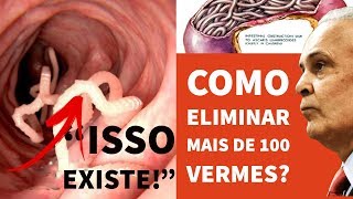 Como Eliminar Mais de 100 VERMES  Dr Lair Ribeiro [upl. by Zillah]