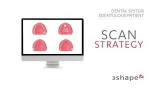 3Shape TRIOS Scan Strategy  Edentulous patient [upl. by Jobie]