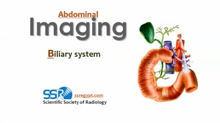 Biliary imaging DRE Prof Mamdouh Mahfouz [upl. by Nnylasor]