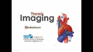 11 Imaging of the mediastinum anatomy and pathology [upl. by Noell]