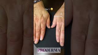 Probando viticolor 🥰 Cuida tu piel… Piensa en proderma [upl. by Rima]