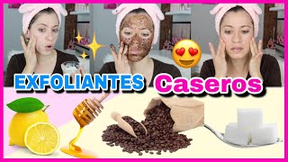 Humectante Casero PIEL GRASA Y CON ACNÉ 🌿 natural 2 ingredientes [upl. by Maurie540]