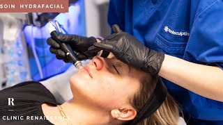 Hydrafacial  les différentes étapes du soin  Clinic Renaissance  médecine esthétique [upl. by Annaerdna]