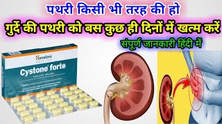 Cystone Forte Tablet  पथरी निकालने की सबसे असरदार दवा  Uses side effects How to use full review [upl. by Notsirk672]