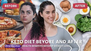 Keto Diet Before and After Health Benefits Beyond Weight Loss [upl. by Sasnak]