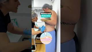 Aplicación de lipo sin cirugía inicia con la mesoterapia reductiva💉✨ chile santiago [upl. by Elyagiba]