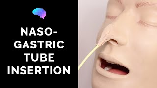 Nasogastric NG Tube Insertion  OSCE Guide  UKMLA  CPSA [upl. by Tildy755]