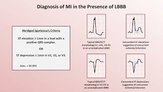 Intro to EKG Interpretation  Myocardial Infarctions Part 2 of 2 [upl. by Nishom]