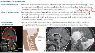 USMLE STEP 1  Neurology  Posterior Fossa Malformations  Syringomyelia [upl. by Auhsohey627]