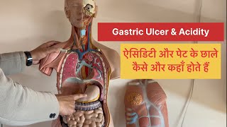 Full Video➡️Gastric Ulcer amp Acidity in Stomach कैसे और कहाँ होता है DigestiveSystem viral trending [upl. by Adien932]