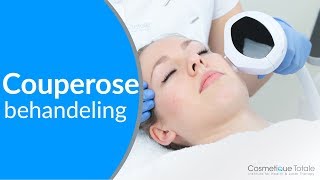 Hoe kan je COUPEROSE VERWIJDEREN Beste COUPEROSE BEHANDELING Laser of IPL [upl. by Elboa]