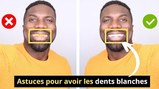 Comment Avoir Les DENTS BLANCHES  BLANCHIR SES DENTS [upl. by Romola]