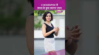 Chickenpox से ऐसे करें खुद का बचाव देखें वीडियो shorts smallpox chickenpox [upl. by Ahcsrop395]