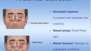 The Pathophysiology of Rhinosinusitis [upl. by Brittaney]