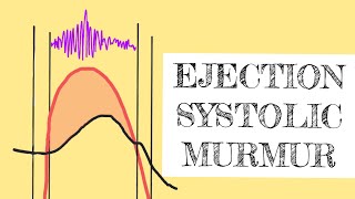 Ejection systolic murmur [upl. by Roleat108]