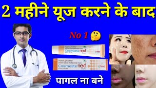 Honest Review Cosmelite Next Cream Cosmelite Cream के फायदे हिंदी में Cosmelite Next Cream 2023 [upl. by Fiden]