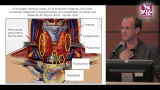 Surgical Treatment for Papillary Thyroid Cancer  Contra Central Neck Dissection [upl. by Coryden]