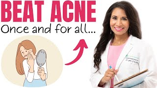 Adult Acne Epidemic What You Need to Know to Get Rid of HORMONAL Acne  Once and for all  Dr Taz [upl. by Adalia]