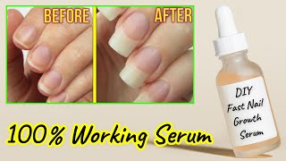 How to make nail growth serum at home  how to grow nails  nails grow faster  Sajal Malik [upl. by Yelyk940]