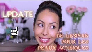 Update Routine Visage suite de ma lutte contre lacné [upl. by Jann887]