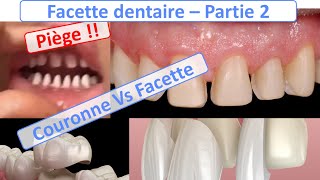 Facette dentaire  Facette Vs Couronnes Piège à éviter  Guide complet  partie 2 [upl. by Schear]