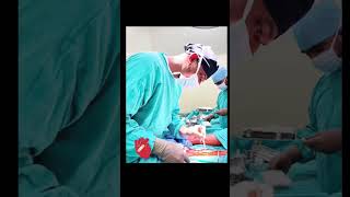 Harvested of sephanous vein for graft of aorta to om or lad ytshorts youtubeshortsshorts vlog69 [upl. by Huesman672]