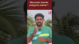 Microcytic Anemia health tamil anemia reason [upl. by Hu]