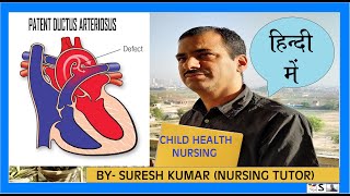 डक्टस आर्टेरीओसस  पूरी जानकारी  PATENT DUCTUS ARTERIOSUS  HINDI [upl. by Nigrom]