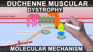 Duchenne Muscular Dystrophy [upl. by Barkley173]