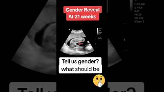 21 weeks baby gender revealed🤩 pregnancy ultrasound viralvideo trending baby [upl. by Nitsed]