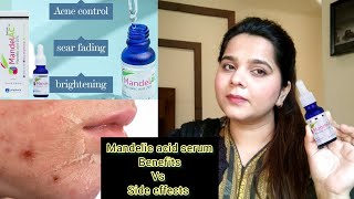 How to use Mandelic acid serum  mandelic acid serum review [upl. by Ennayrb475]