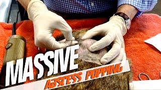 Massive Abscess Popping [upl. by Pablo361]