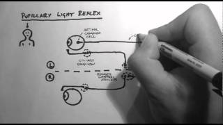 Reflexes 2  Pupillary Light Reflex [upl. by Crain501]